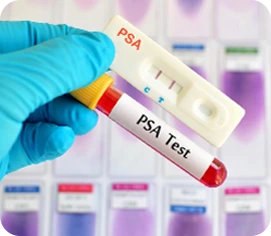 PSA Screening